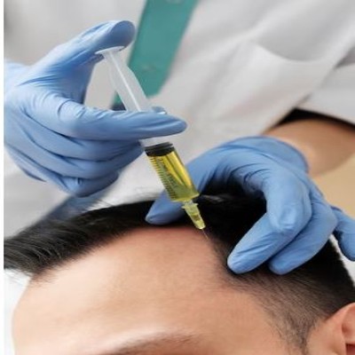 PRP FOR HAIR & FACE