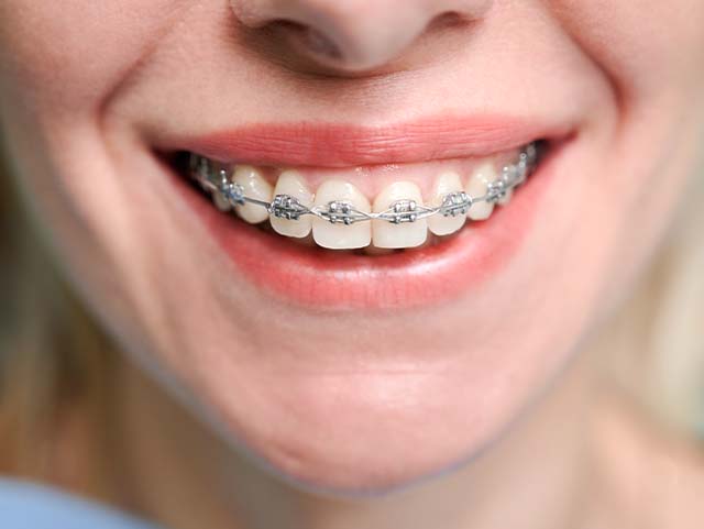 best orthodontist in abu dhabi