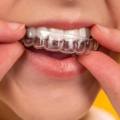Dental implants in Abu Dhabi